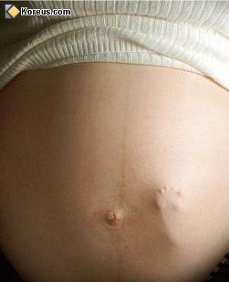 Avant de voir le jour et le jour de ma naissance